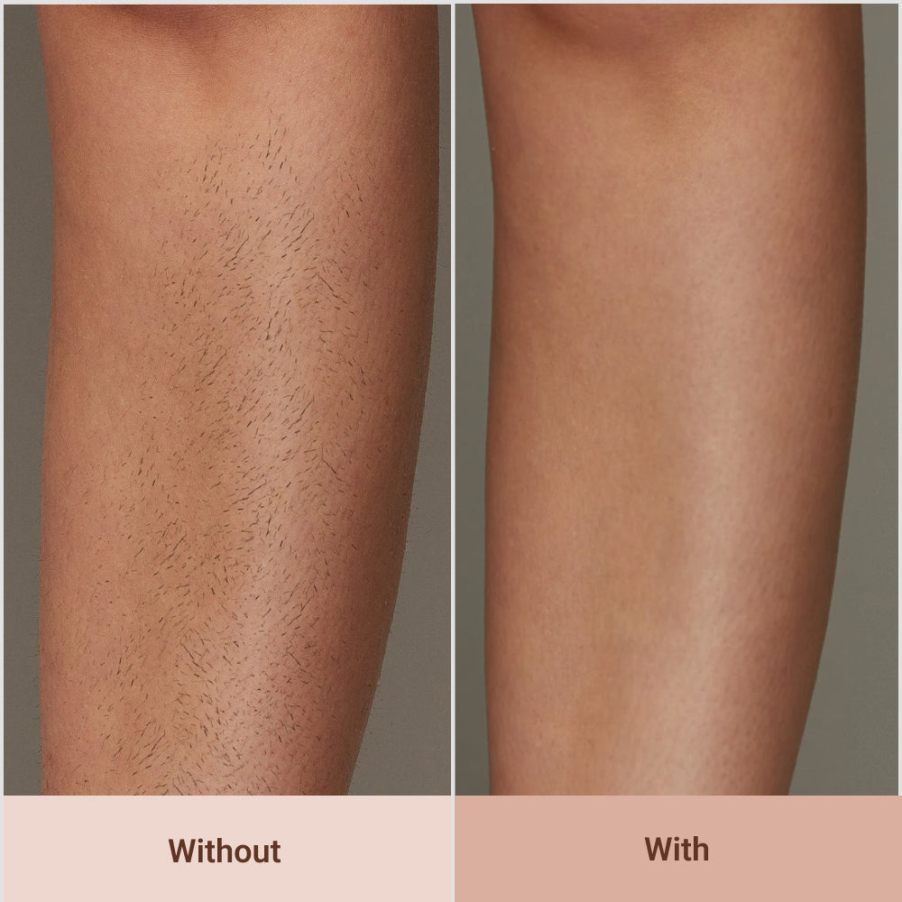 Lunn Store - IPL Hair Removal Epilator